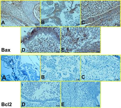 Cytotoxicity of Amphotericin B and AmBisome: In Silico and In Vivo Evaluation Employing the Chick Embryo Model